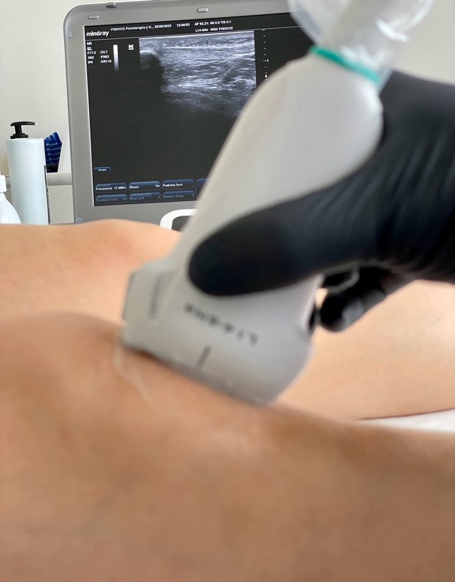 Tratamientos de Fisioterapia Ecoguiados