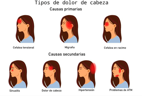 TIPOS DE DOLORES DE CABEZA